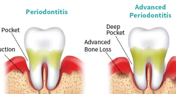 Salem Periodontal and Implant Specialist 